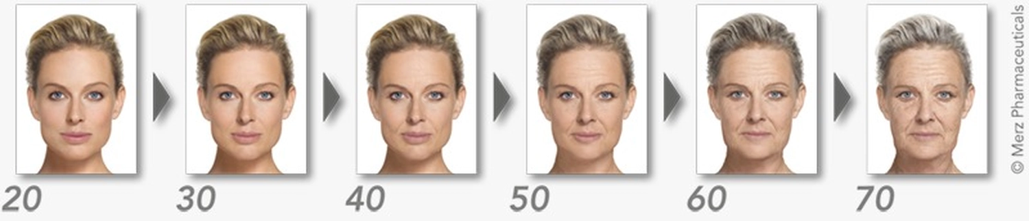 Privatpraxis Dr. Kusian - ästhetische Medizin - Botulinumtoxin-Behandlung (Botox)